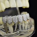 Big Starz Flooded Bottom Grillz — Silver Tone