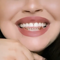 Yellow Gold 14K Gold-Plated Fang Grillz
