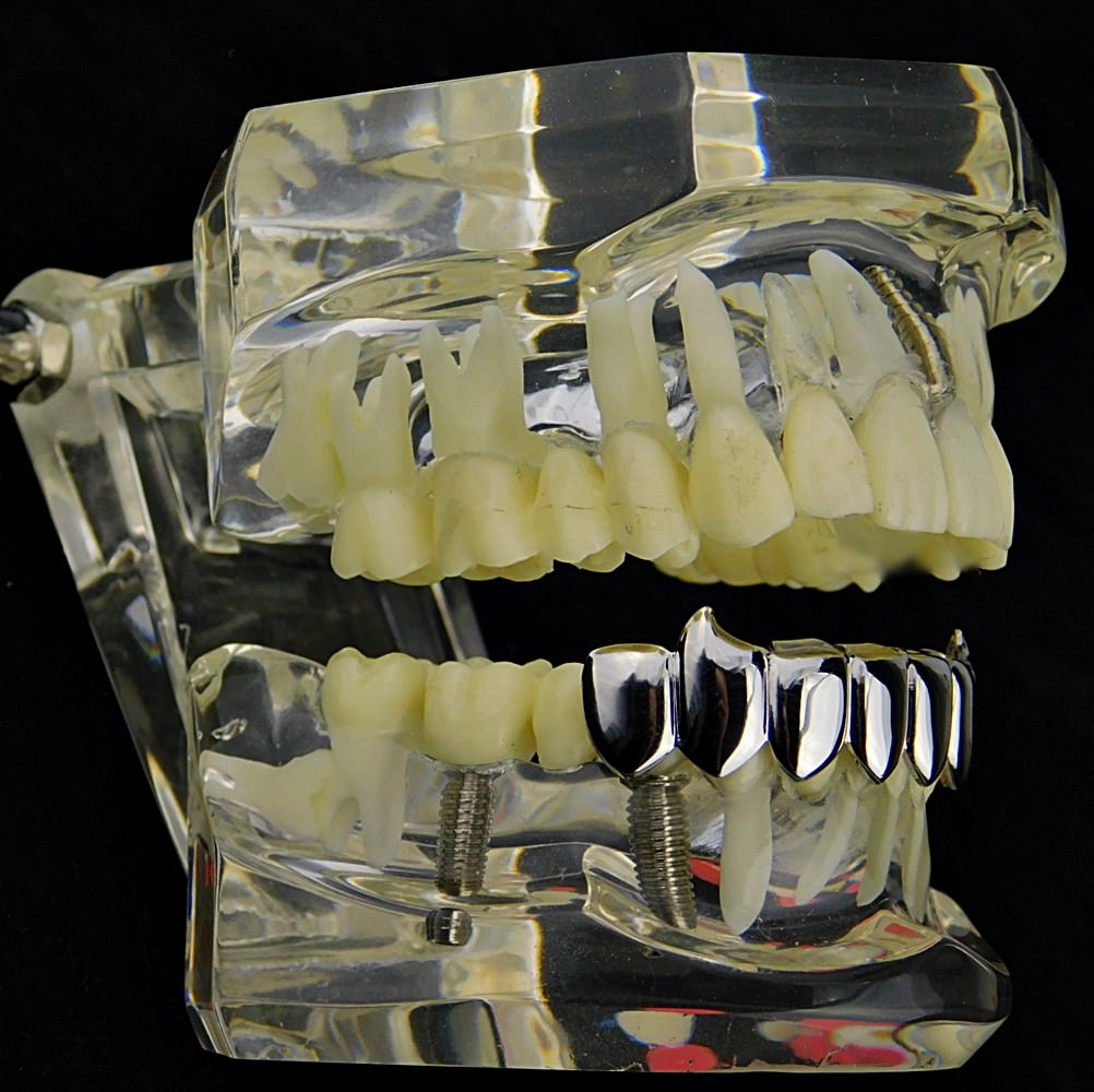 Big Starz Fang Grillz — Silver-Tone, Bottom Set