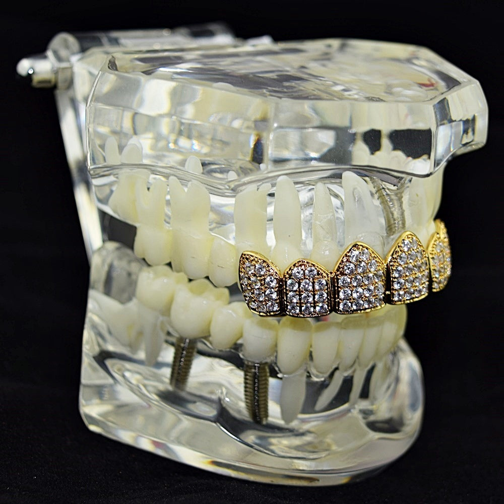 Big Starz Iced Top Grillz — 18K Gold Plated