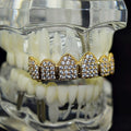 Big Starz Iced Top Grillz — 18K Gold Plated